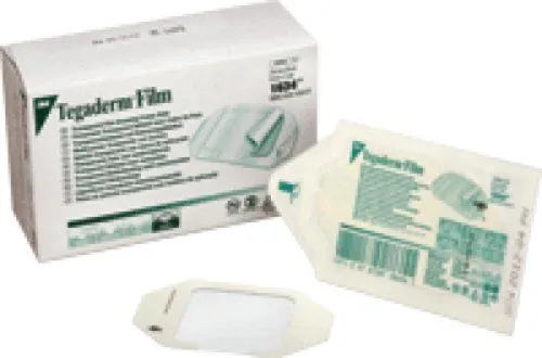 3M Tegaderm 1634 Transparent Adhesive Film Dressing Frame Style, Waterproof, Sterile 2-3/8" x 2-3/4", 1 Count